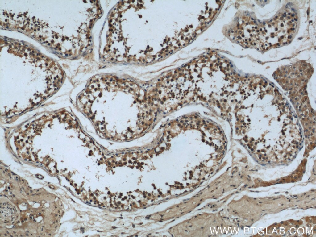 IHC staining of human testis using 66014-1-Ig