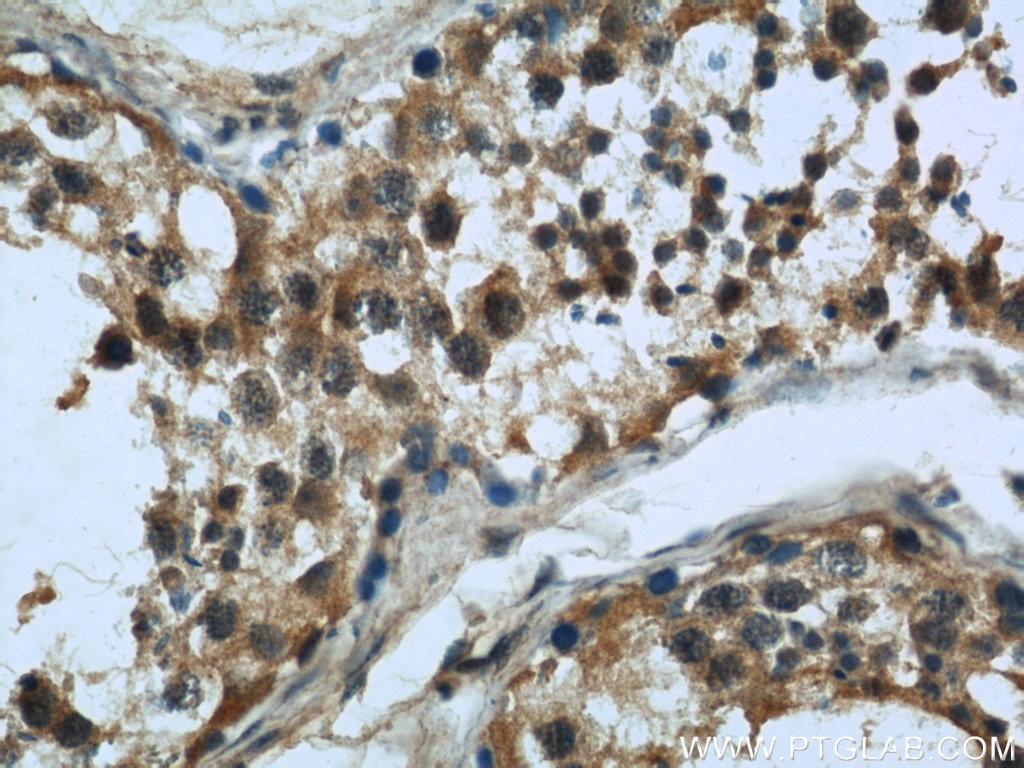 Immunohistochemistry (IHC) staining of human testis tissue using MAD2L1 Monoclonal antibody (66014-1-Ig)