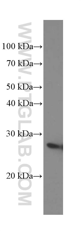 Western Blot (WB) analysis of HeLa cells using MAD2L1 Monoclonal antibody (66014-1-Ig)