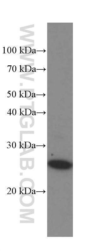 Western Blot (WB) analysis of HEK-293 cells using MAD2L1 Monoclonal antibody (66014-1-Ig)