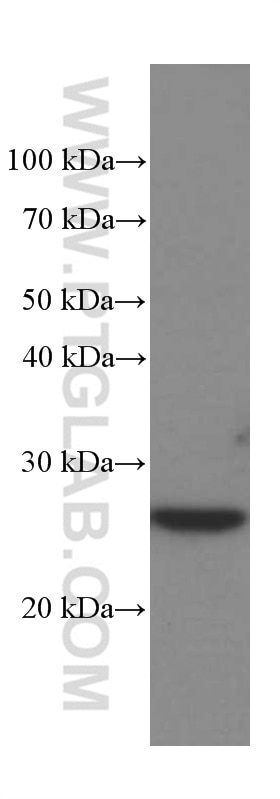 Western Blot (WB) analysis of Jurkat cells using MAD2L1 Monoclonal antibody (66014-1-Ig)