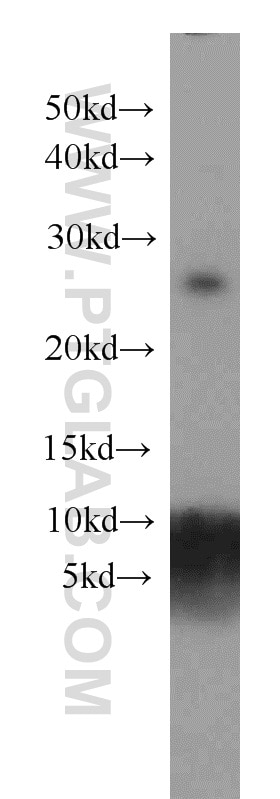 Western Blot (WB) analysis of COLO 320 cells using MAD2L1 Monoclonal antibody (66014-1-Ig)