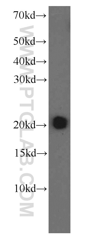 Western Blot (WB) analysis of HEK-293 cells using MAD2L1 Monoclonal antibody (66014-1-Ig)