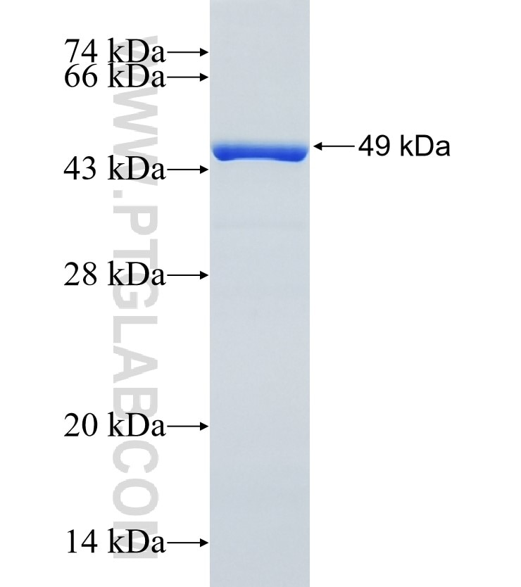 MAD2L1 fusion protein Ag0307 SDS-PAGE