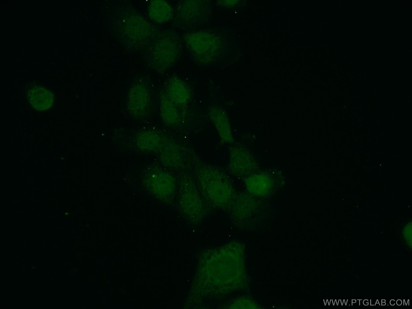Immunofluorescence (IF) / fluorescent staining of A431 cells using MAD2L1BP Polyclonal antibody (15344-1-AP)