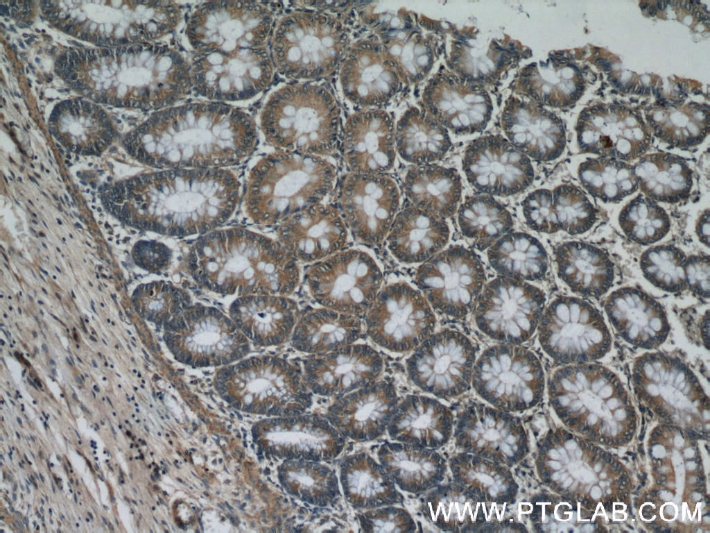 Immunohistochemistry (IHC) staining of human colon tissue using MAD2L1BP Polyclonal antibody (15344-1-AP)