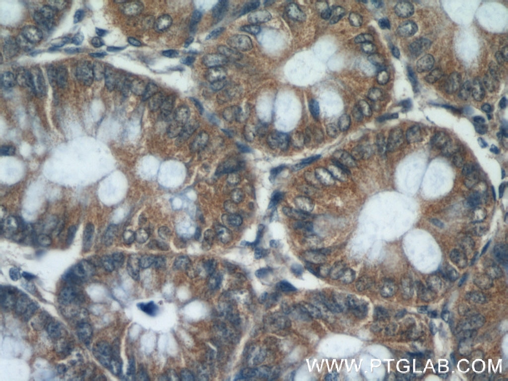 Immunohistochemistry (IHC) staining of human colon tissue using MAD2L1BP Polyclonal antibody (15344-1-AP)