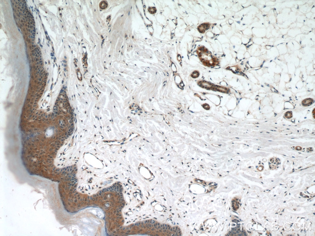 Immunohistochemistry (IHC) staining of human skin tissue using MAD2L1BP Polyclonal antibody (15344-1-AP)