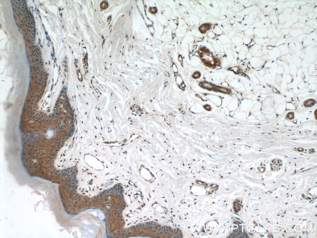 IHC staining of human skin using 15344-1-AP