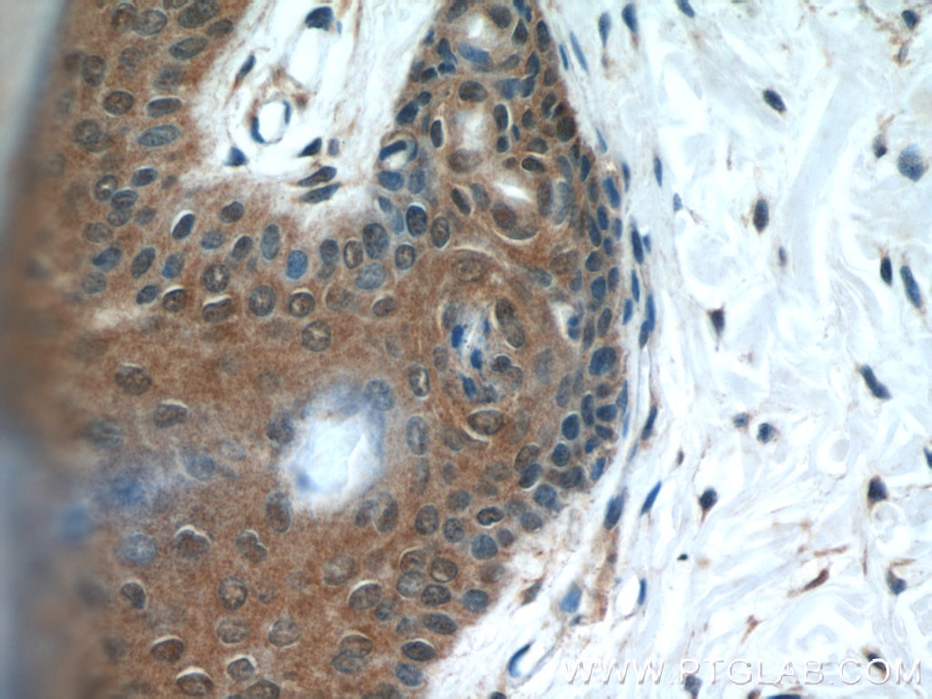 Immunohistochemistry (IHC) staining of human skin tissue using MAD2L1BP Polyclonal antibody (15344-1-AP)