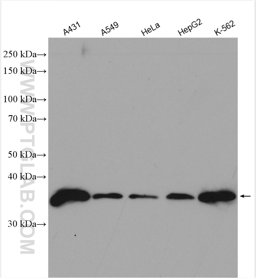 Western Blot (WB) analysis of various lysates using MAD2L1BP Polyclonal antibody (15344-1-AP)