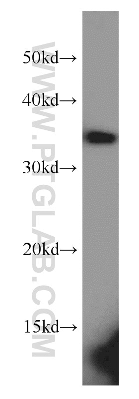 Western Blot (WB) analysis of K-562 cells using MAD2L1BP Polyclonal antibody (15344-1-AP)