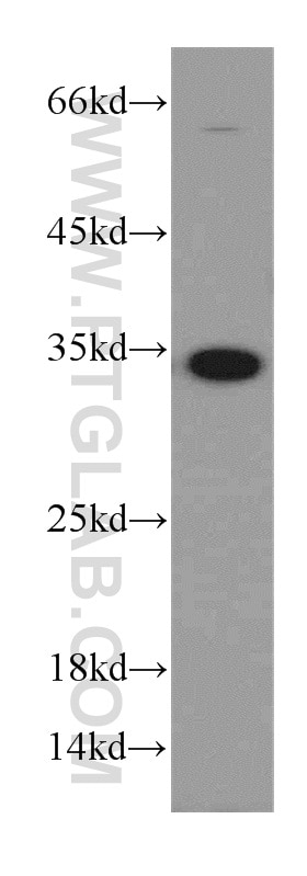 Western Blot (WB) analysis of HeLa cells using MAD2L1BP Polyclonal antibody (15344-1-AP)