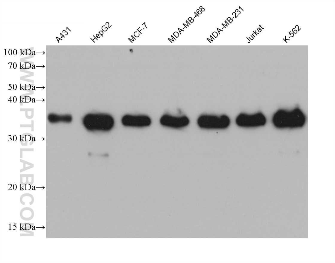 Western Blot (WB) analysis of various lysates using MAD2L1BP Monoclonal antibody (68336-1-Ig)