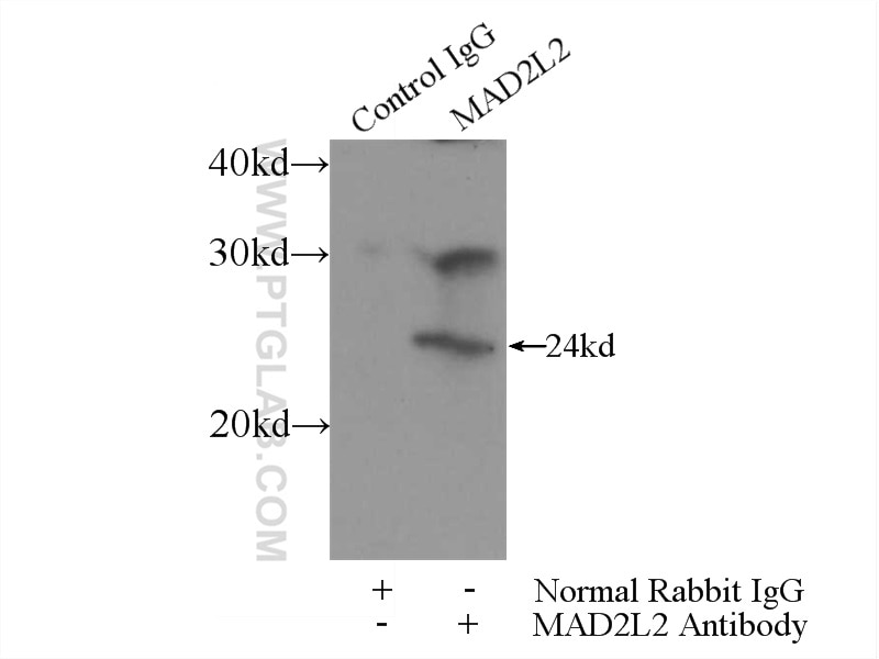 Immunoprecipitation (IP) experiment of mouse brain tissue using MAD2L2 Polyclonal antibody (12683-1-AP)
