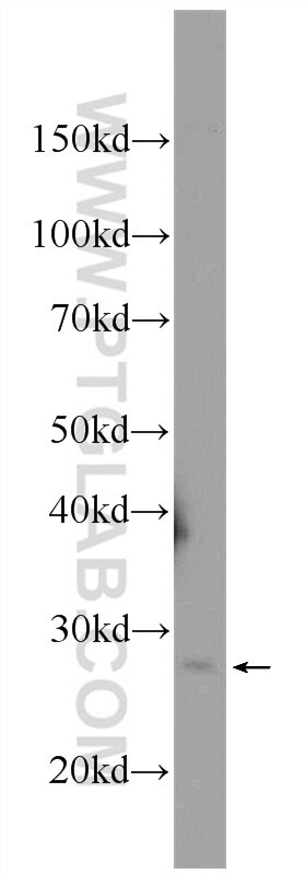 Western Blot (WB) analysis of mouse brain tissue using MAD2L2 Polyclonal antibody (12683-1-AP)
