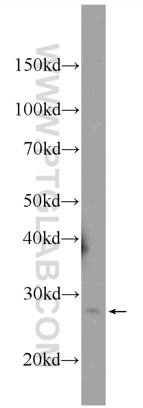 Western Blot (WB) analysis of mouse brain tissue using MAD2L2 Polyclonal antibody (12683-1-AP)