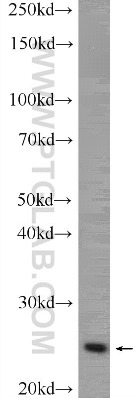 WB analysis of HeLa using 12683-1-AP