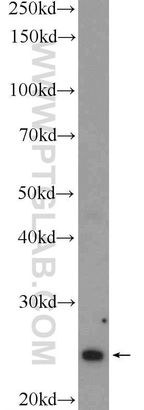 Western Blot (WB) analysis of HEK-293 cells using MAD2L2 Polyclonal antibody (12683-1-AP)