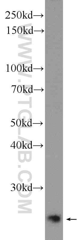 Western Blot (WB) analysis of fetal human brain tissue using MAD2L2 Polyclonal antibody (12683-1-AP)