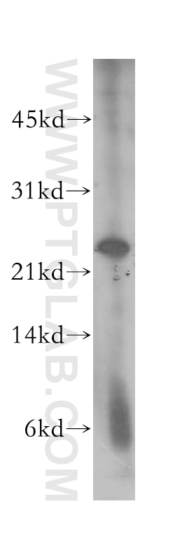 Western Blot (WB) analysis of A375 cells using MAD2L2 Polyclonal antibody (12683-1-AP)