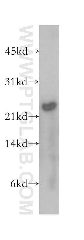 Western Blot (WB) analysis of human brain tissue using MAD2L2 Polyclonal antibody (12683-1-AP)