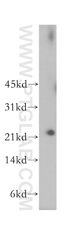 Western Blot (WB) analysis of human kidney tissue using MAD2L2 Polyclonal antibody (12683-1-AP)