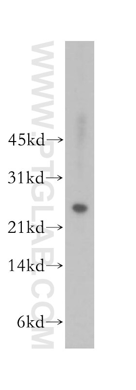 Western Blot (WB) analysis of human colon tissue using MAD2L2 Polyclonal antibody (12683-1-AP)