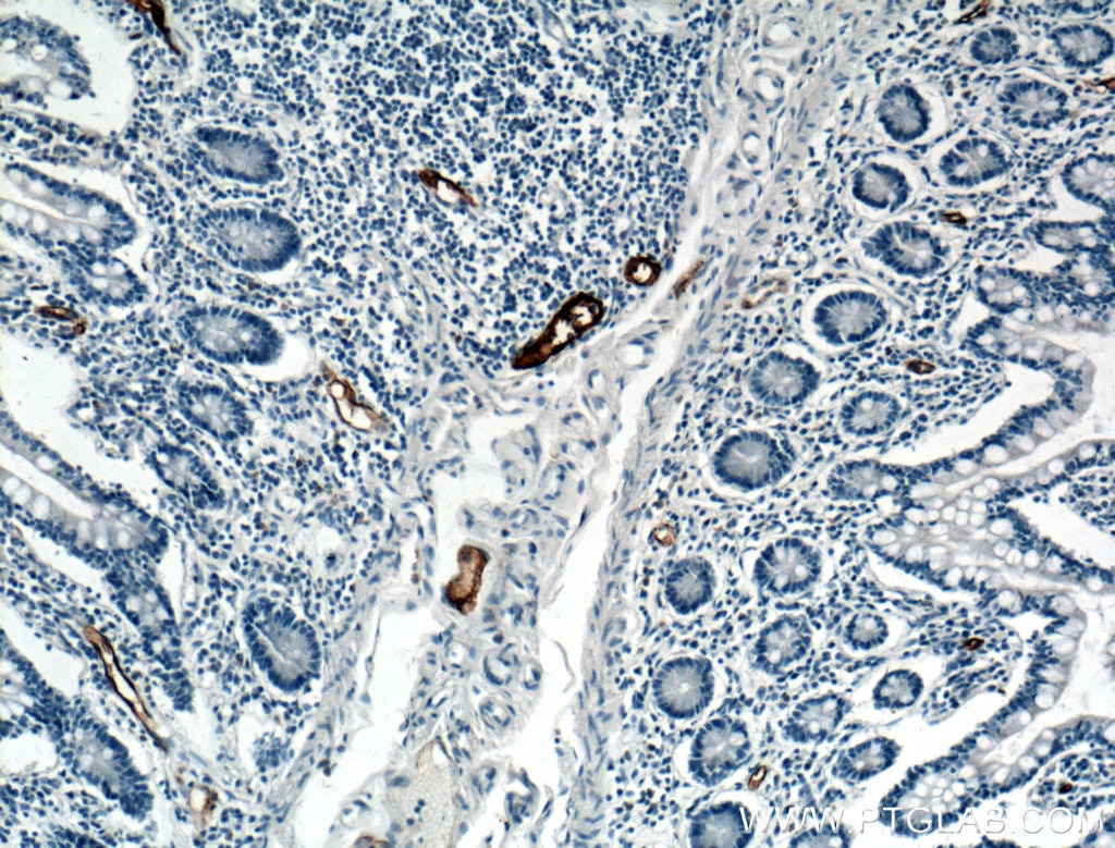 IHC staining of human small intestine using 21917-1-AP