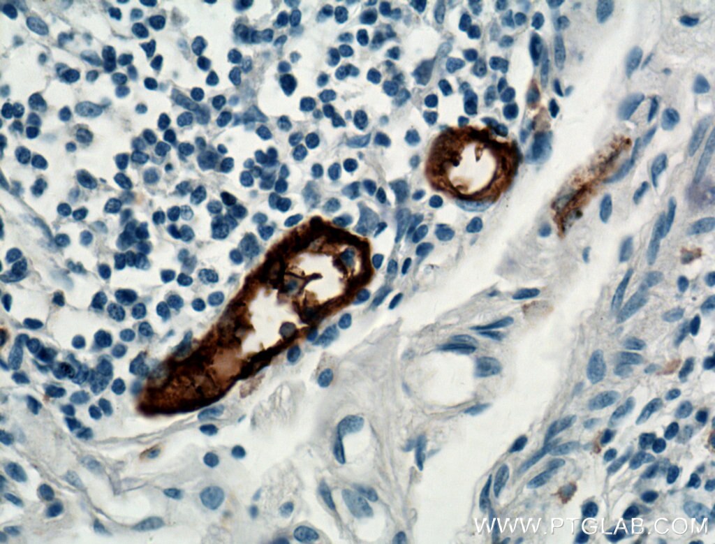 Immunohistochemistry (IHC) staining of human small intestine tissue using MAdCAM1 Polyclonal antibody (21917-1-AP)