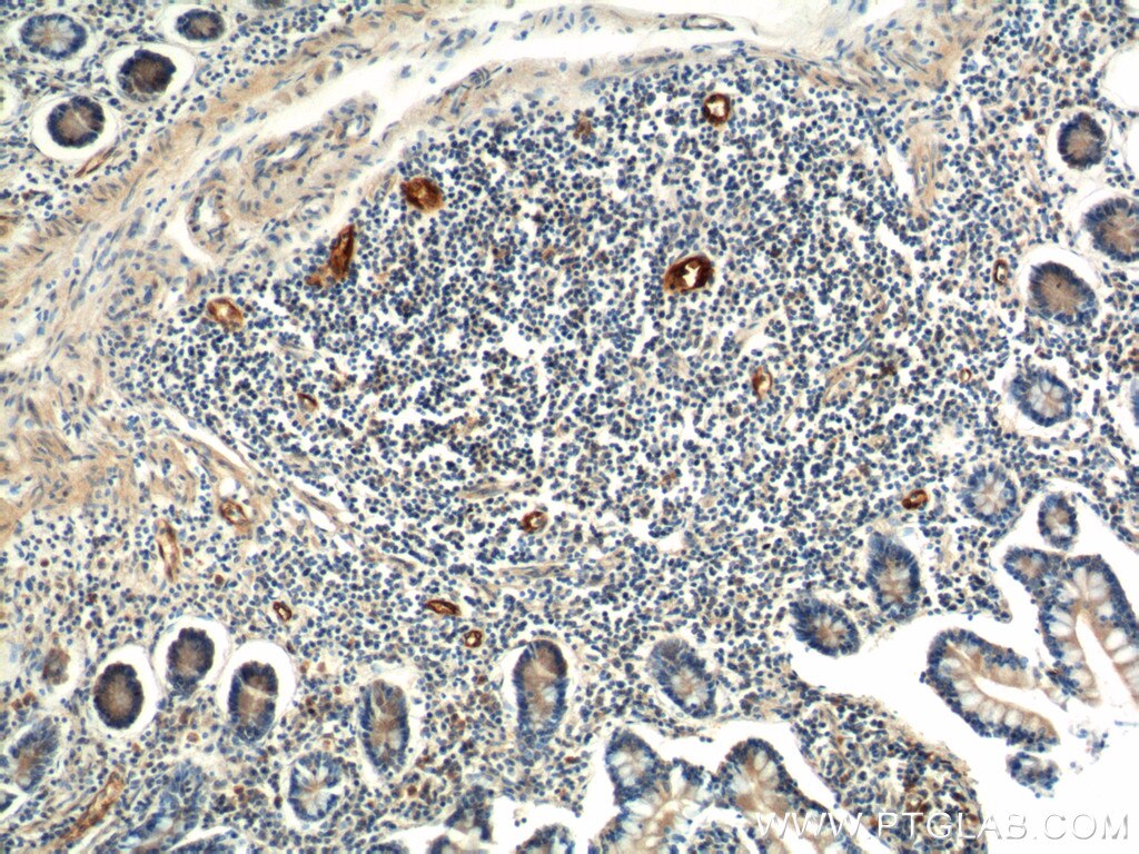 Immunohistochemistry (IHC) staining of human small intestine tissue using MAdCAM1 Polyclonal antibody (21917-1-AP)