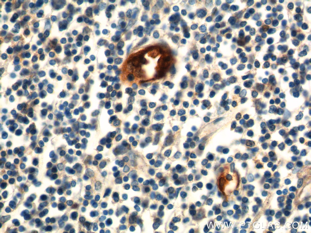 Immunohistochemistry (IHC) staining of human small intestine tissue using MAdCAM1 Polyclonal antibody (21917-1-AP)