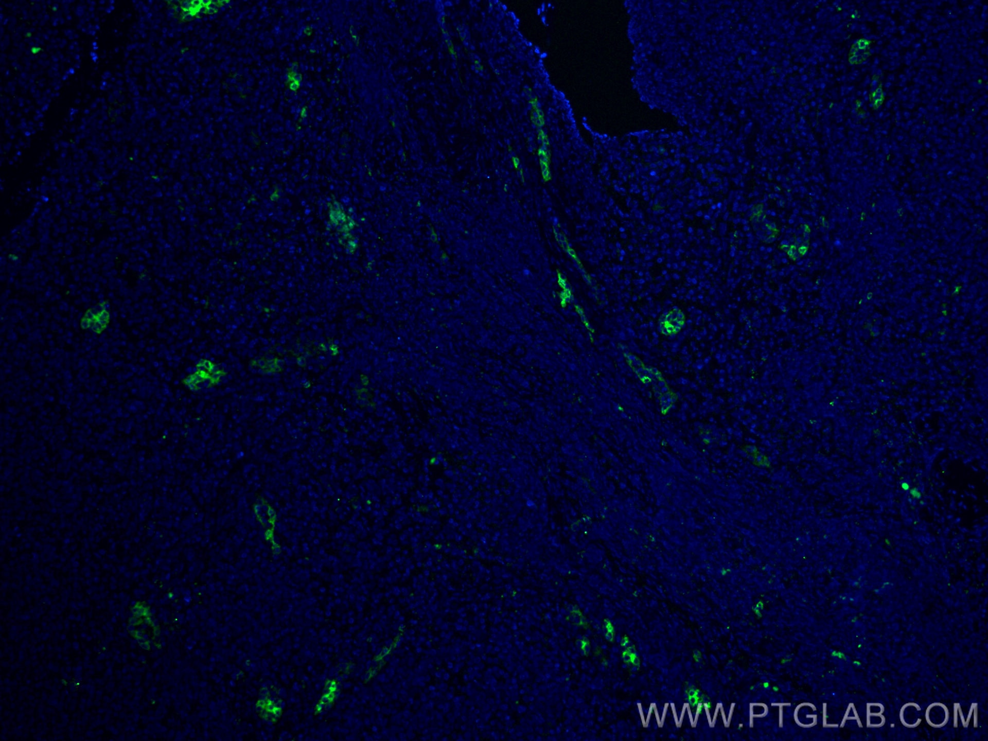 Immunofluorescence (IF) / fluorescent staining of human tonsillitis tissue using MAdCAM1 Monoclonal antibody (66594-1-Ig)