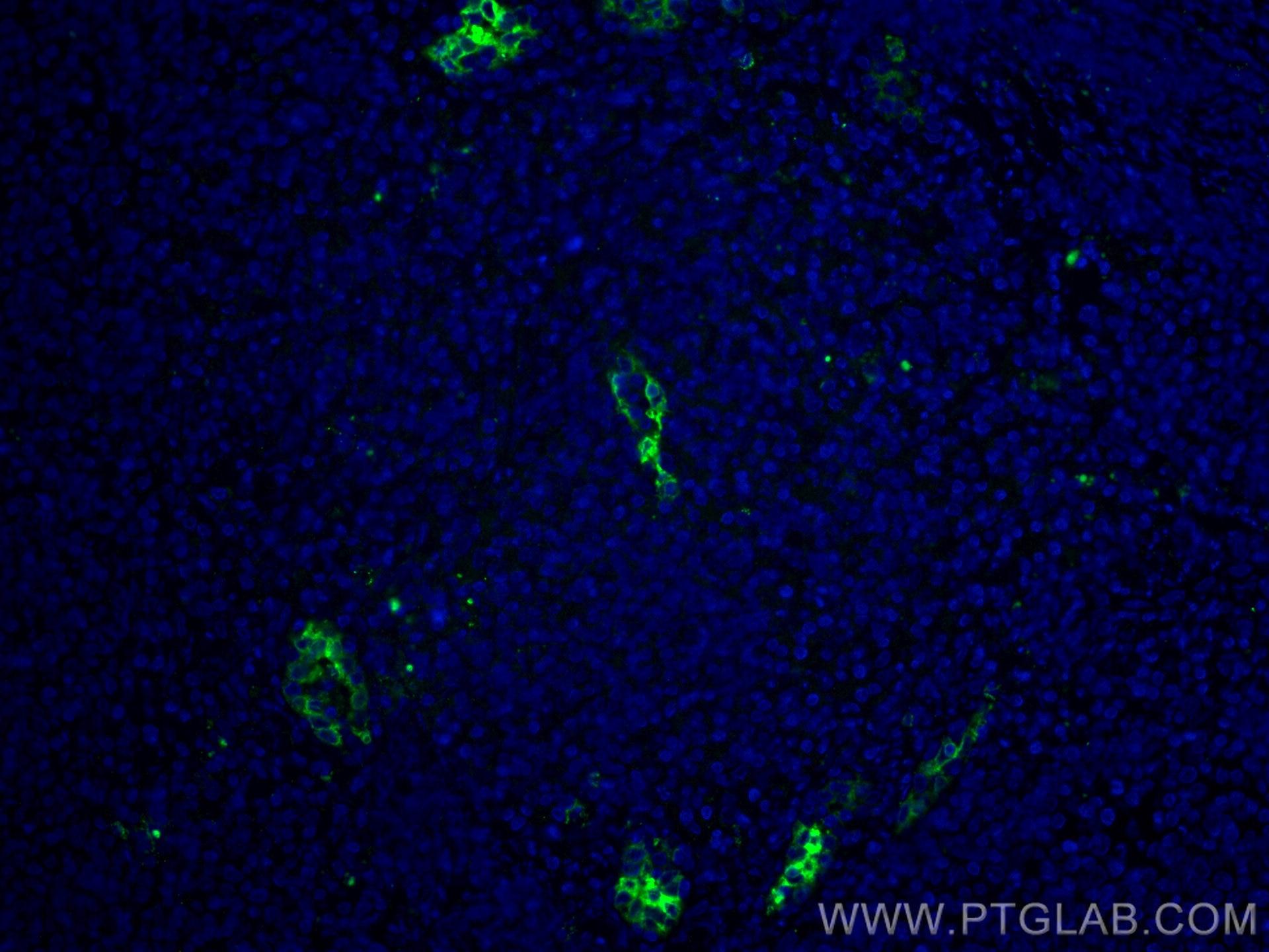 Immunofluorescence (IF) / fluorescent staining of human tonsillitis tissue using MAdCAM1 Monoclonal antibody (66594-1-Ig)