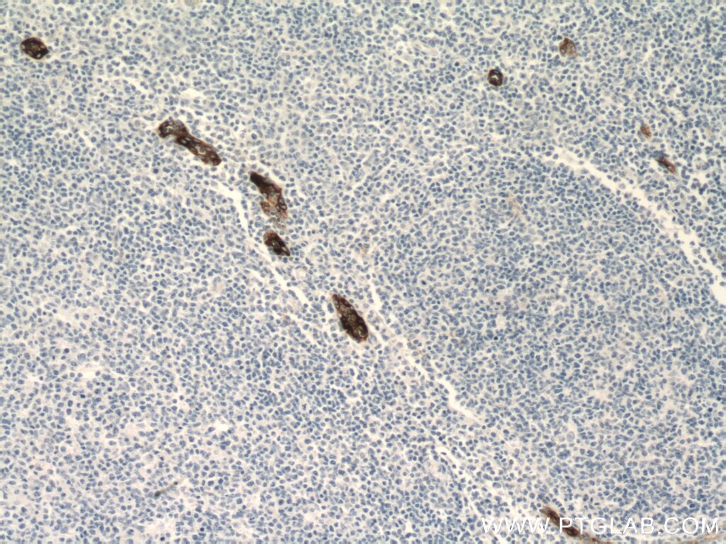 Immunohistochemistry (IHC) staining of human tonsillitis tissue using MAdCAM1 Monoclonal antibody (66594-1-Ig)