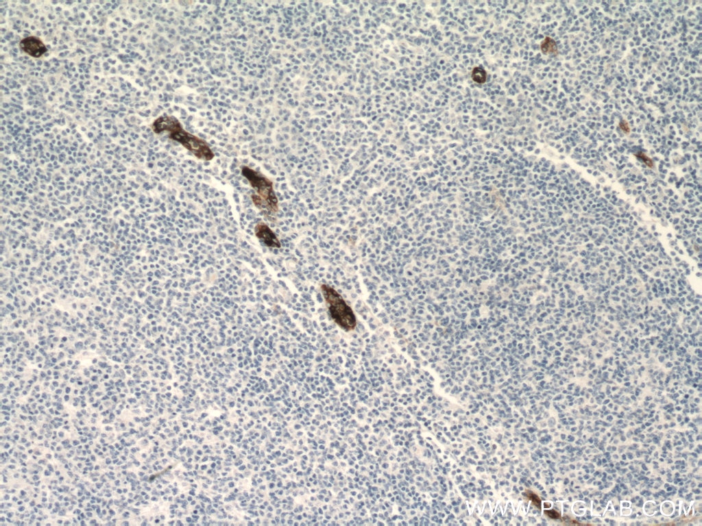 Immunohistochemistry (IHC) staining of human tonsillitis tissue using MAdCAM1 Monoclonal antibody (66594-1-Ig)