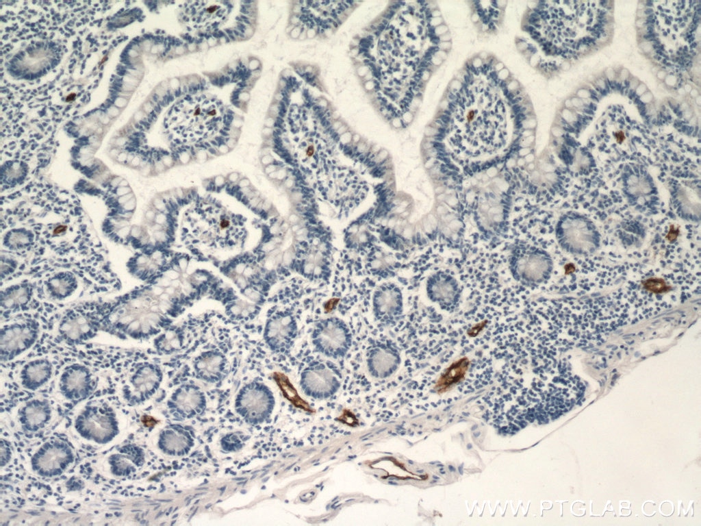 Immunohistochemistry (IHC) staining of human small intestine tissue using MAdCAM1 Monoclonal antibody (66594-1-Ig)