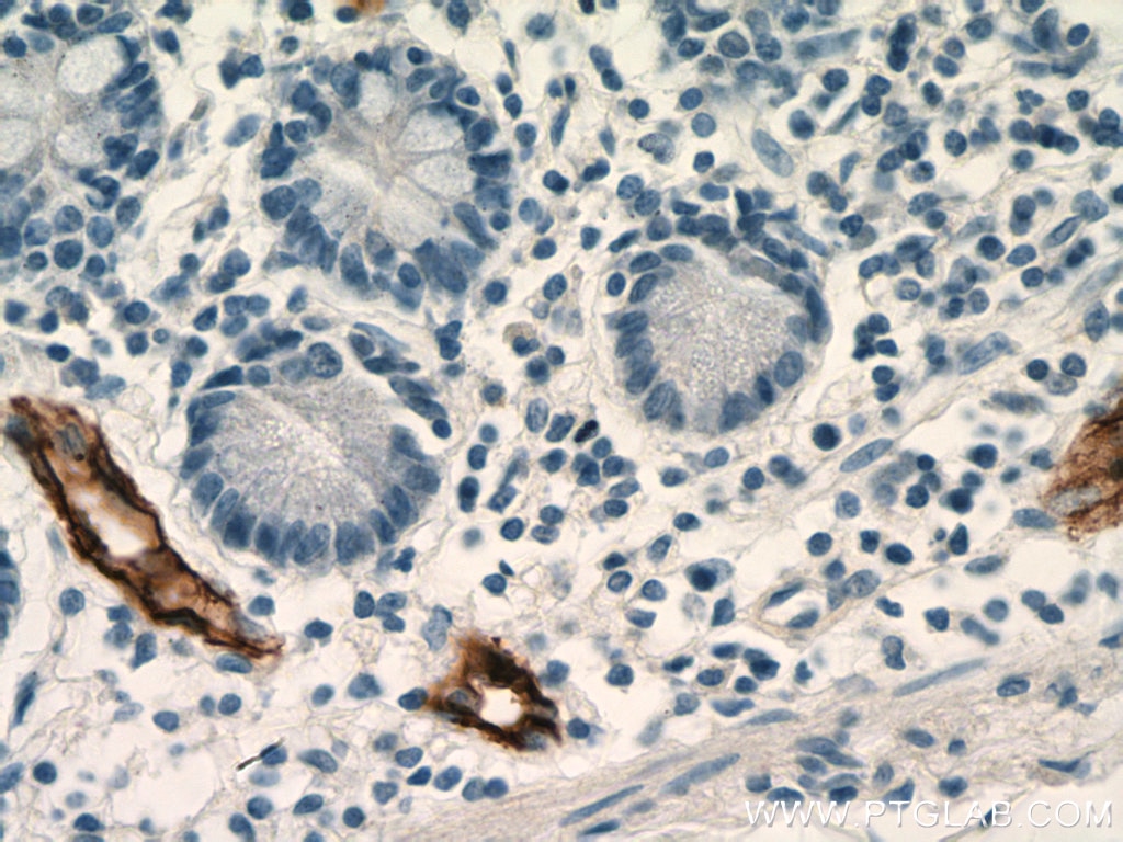 Immunohistochemistry (IHC) staining of human small intestine tissue using MAdCAM1 Monoclonal antibody (66594-1-Ig)