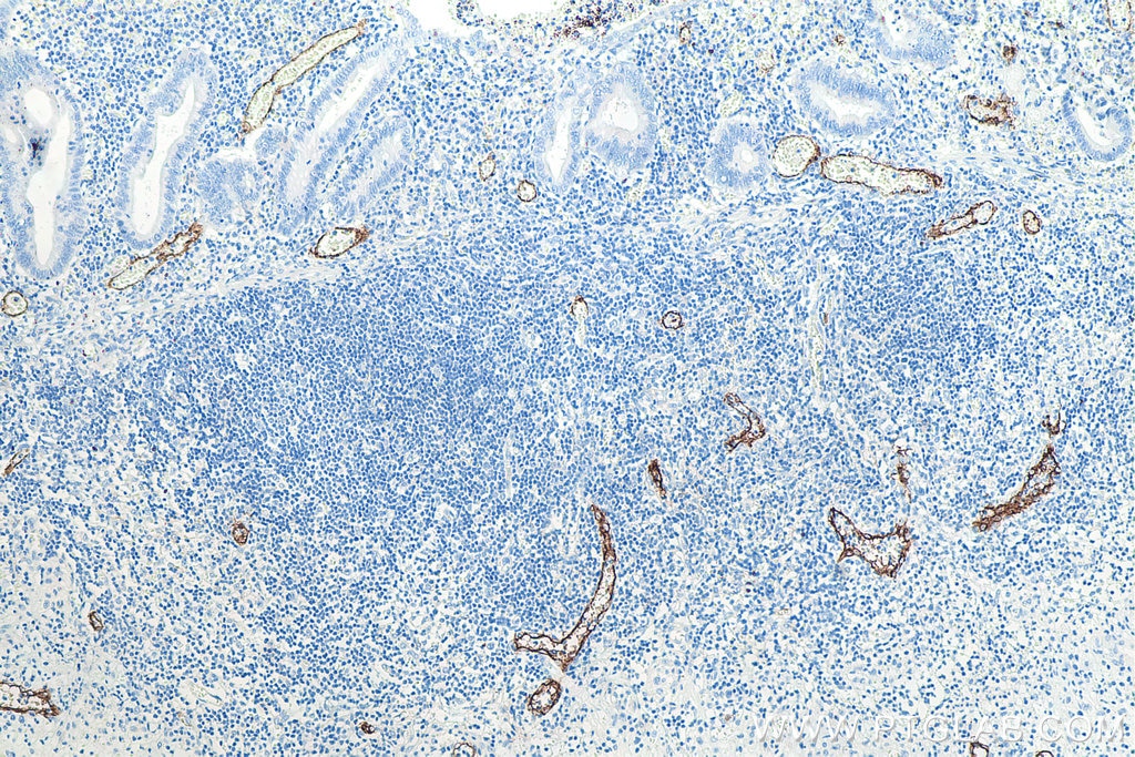 Immunohistochemistry (IHC) staining of human appendicitis tissue using MAdCAM1 Monoclonal antibody (66594-1-Ig)