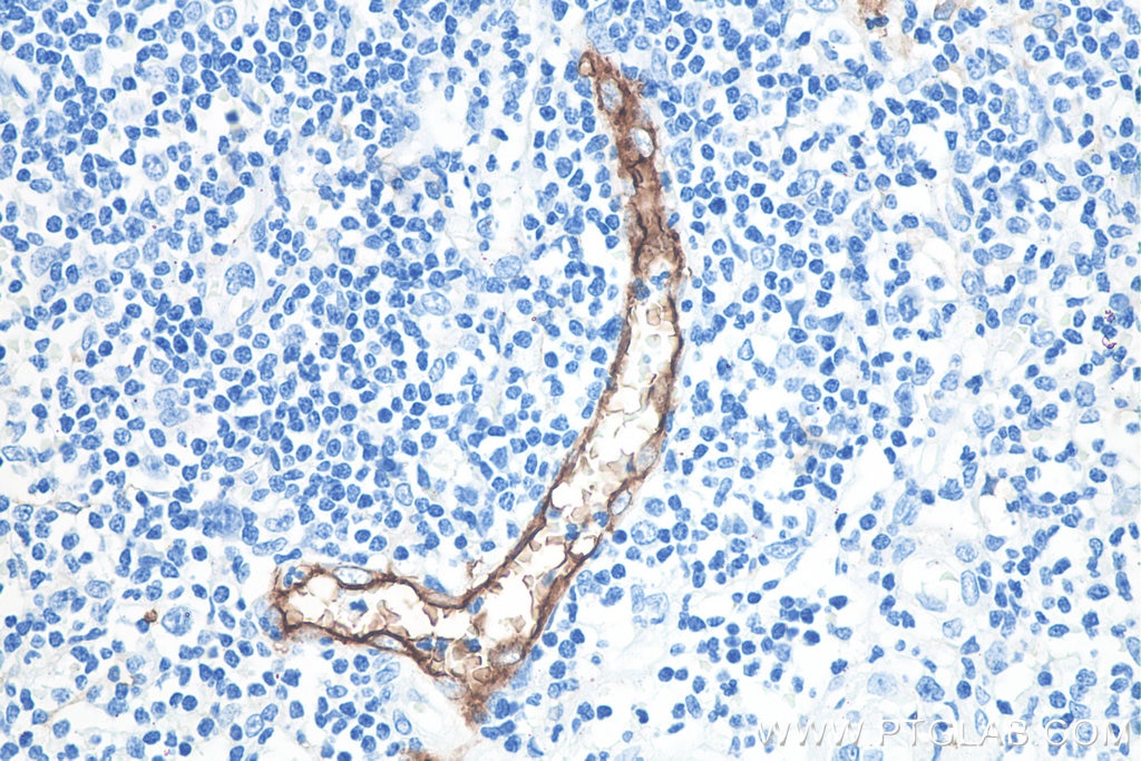 Immunohistochemistry (IHC) staining of human appendicitis tissue using MAdCAM1 Monoclonal antibody (66594-1-Ig)