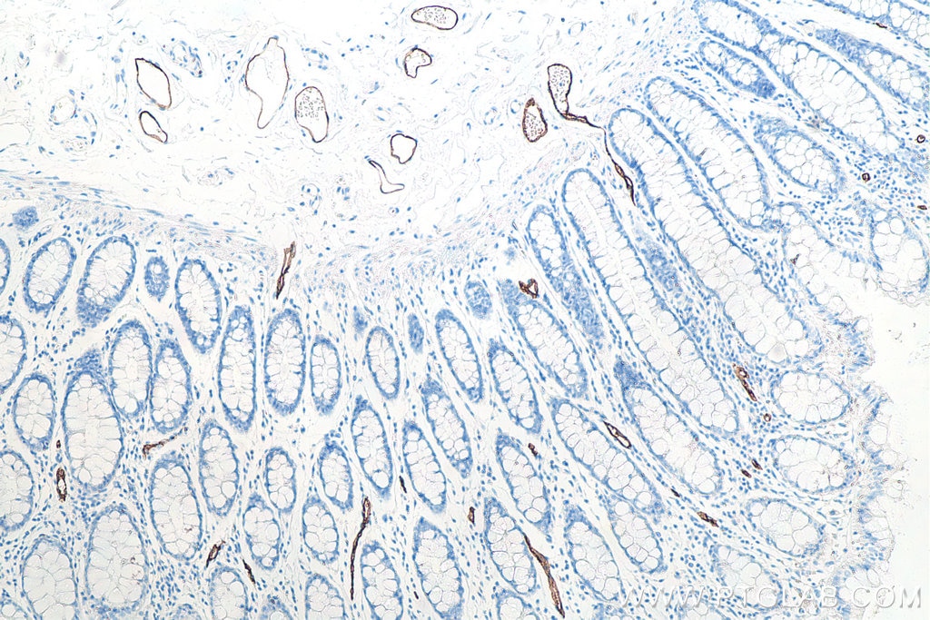 Immunohistochemistry (IHC) staining of human colon tissue using MAdCAM1 Monoclonal antibody (66594-1-Ig)