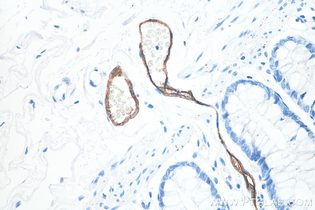 Immunohistochemistry (IHC) staining of human colon tissue using MAdCAM1 Monoclonal antibody (66594-1-Ig)