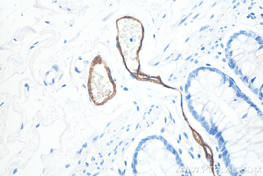 IHC staining of human colon using 66594-1-Ig