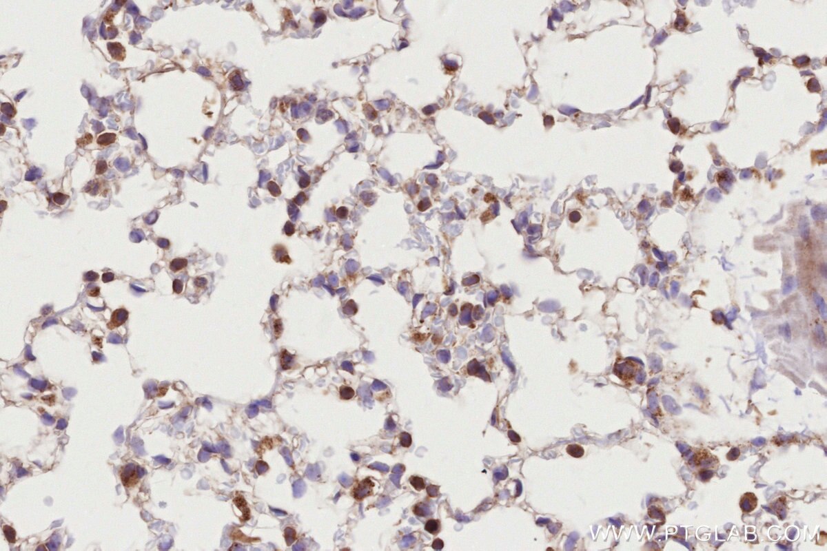 Immunohistochemistry (IHC) staining of mouse lung tissue using MADD Polyclonal antibody (29663-1-AP)