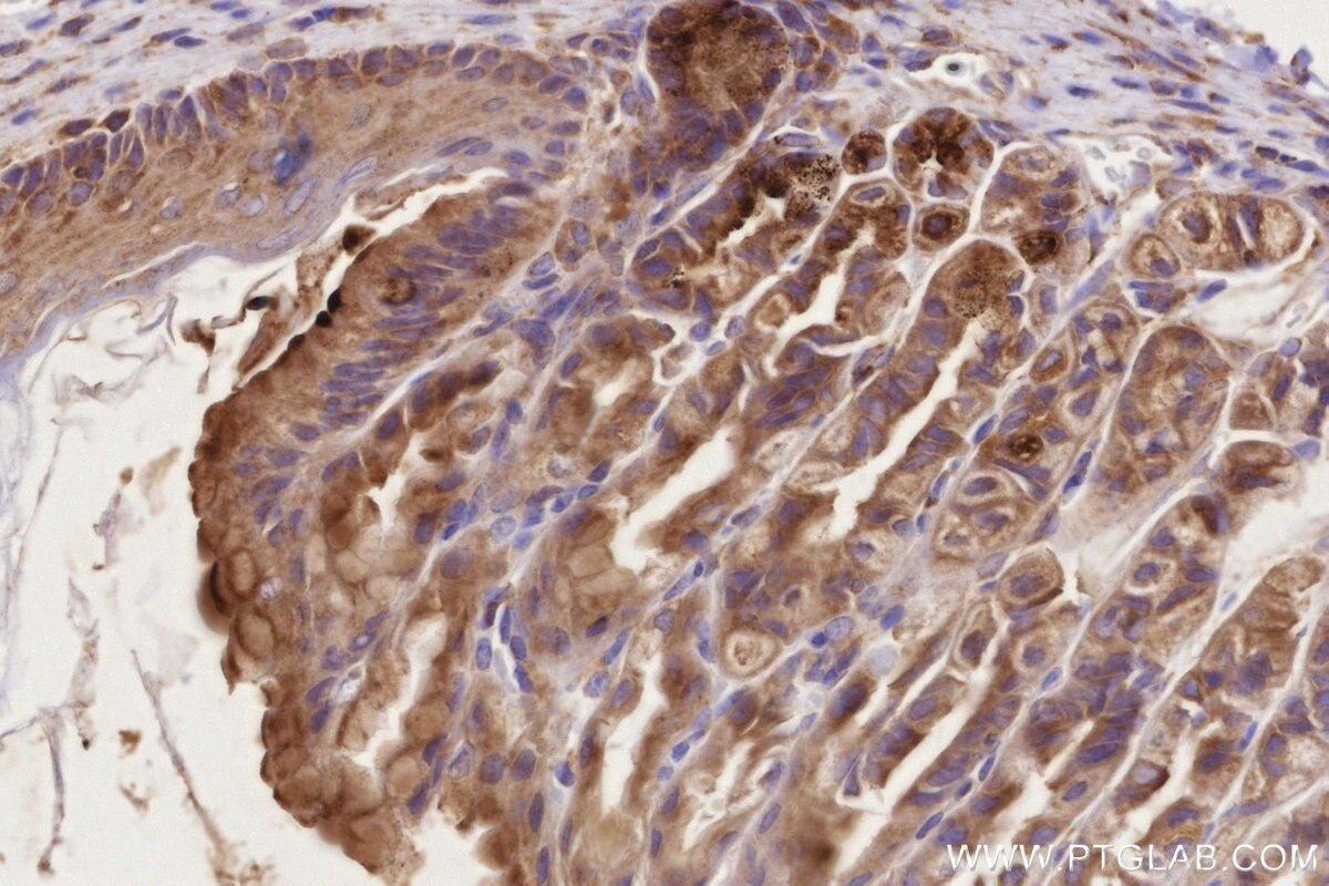 Immunohistochemistry (IHC) staining of mouse stomach tissue using MADD Polyclonal antibody (29663-1-AP)