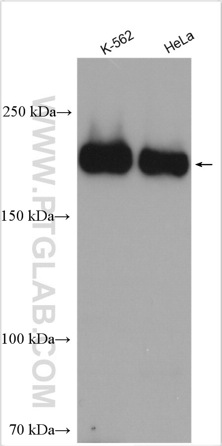 Western Blot (WB) analysis of various lysates using MADD Polyclonal antibody (29663-1-AP)