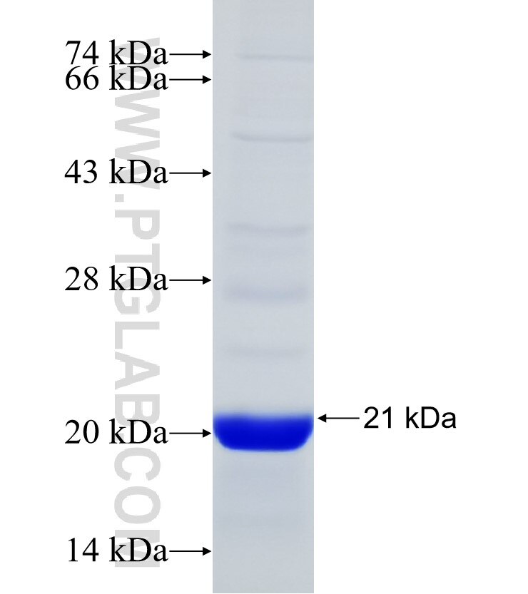 MADD fusion protein Ag31302 SDS-PAGE