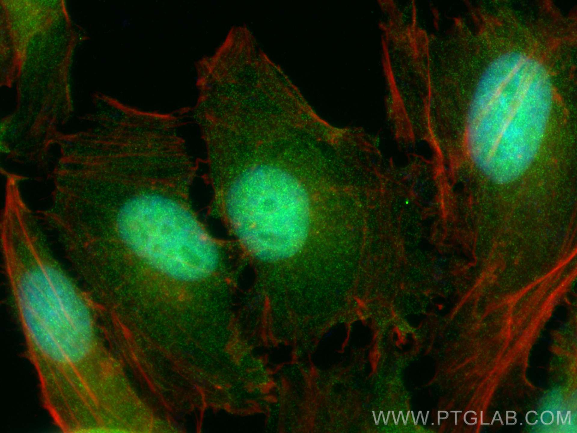 Immunofluorescence (IF) / fluorescent staining of HeLa cells using Multi-rAb™ MAEA Multi-Recombinant antibody (RMX00005)