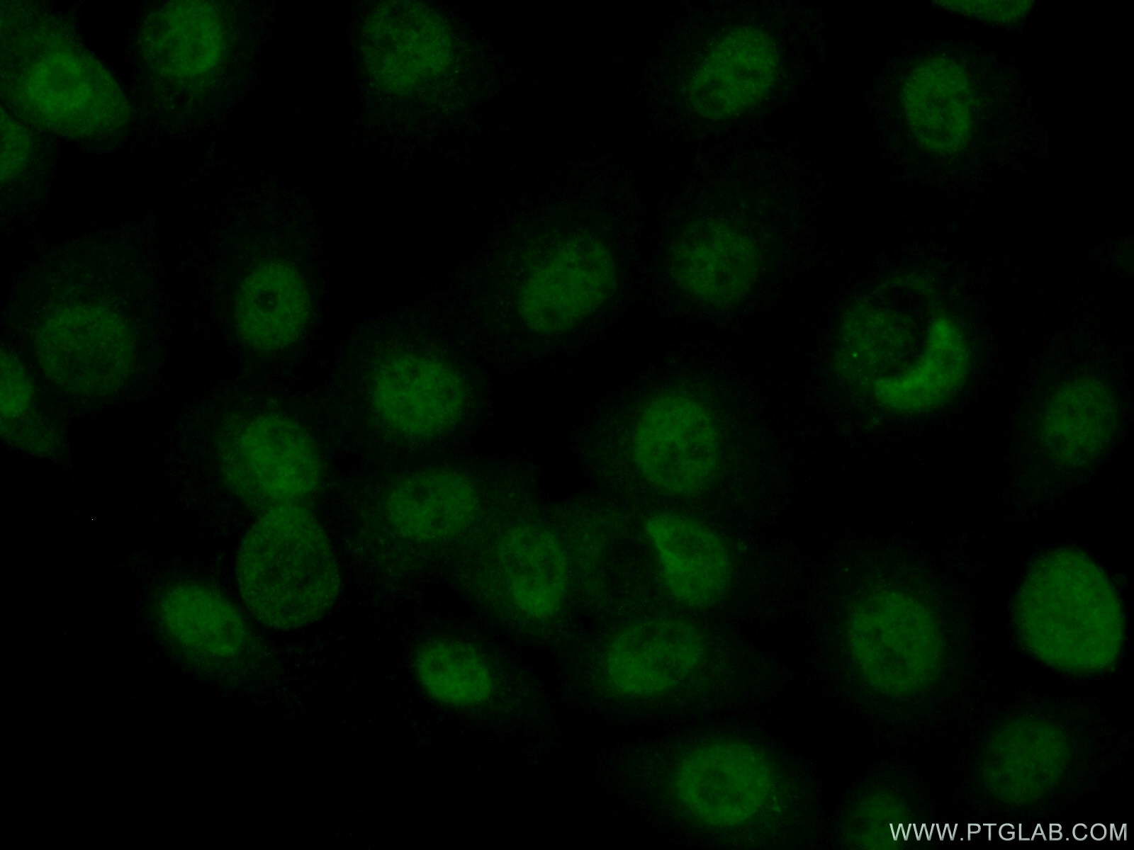 Immunofluorescence (IF) / fluorescent staining of A431 cells using MAF Polyclonal antibody (55013-1-AP)