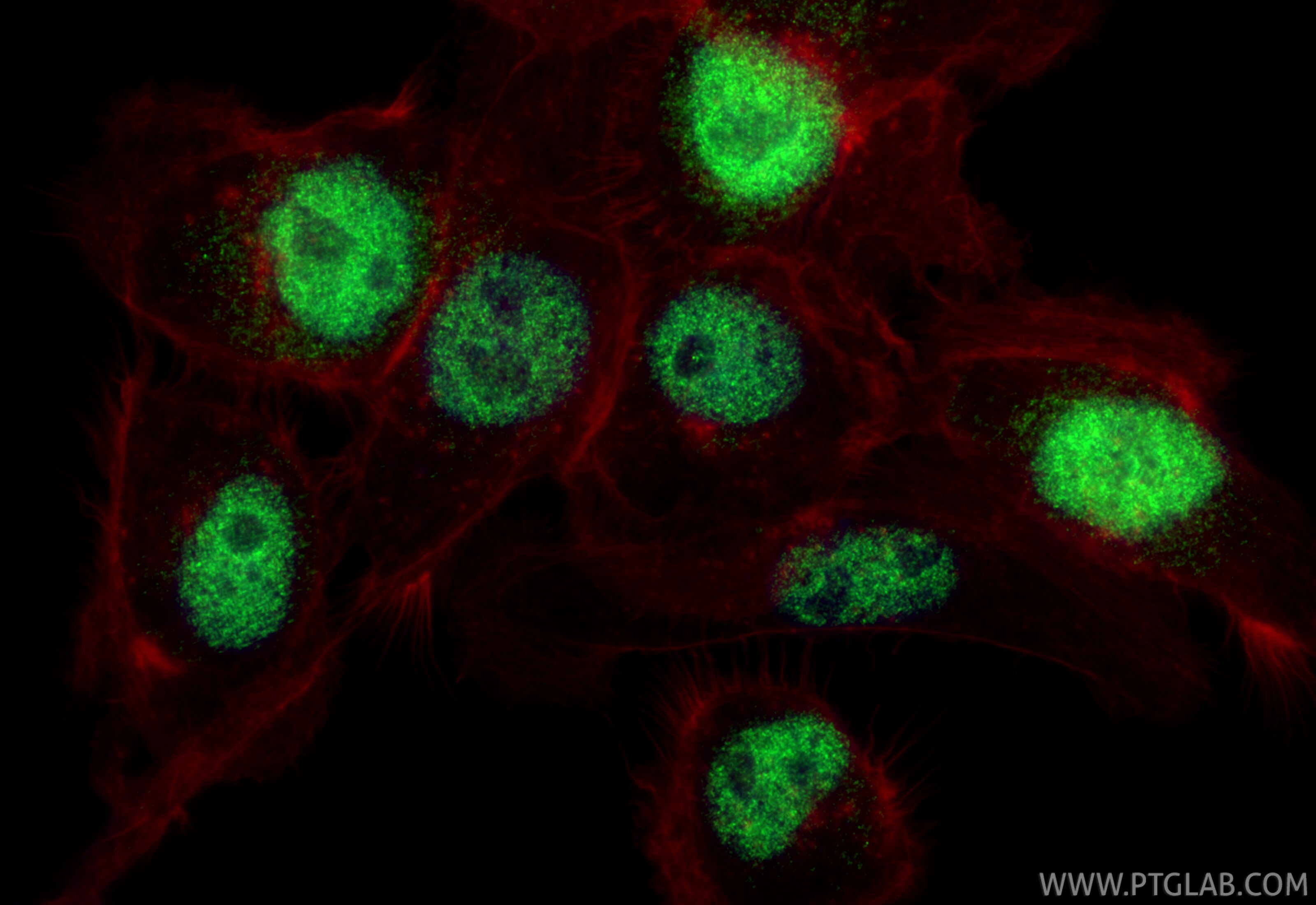 Immunofluorescence (IF) / fluorescent staining of A431 cells using c-MAF Polyclonal antibody (55013-1-AP)